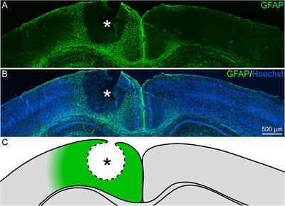 Laser Lesion in the Mouse Visual Cortex Induces a Stem Cell Niche-Like Extracellular Matrix, Produced by Immature Astrocytes